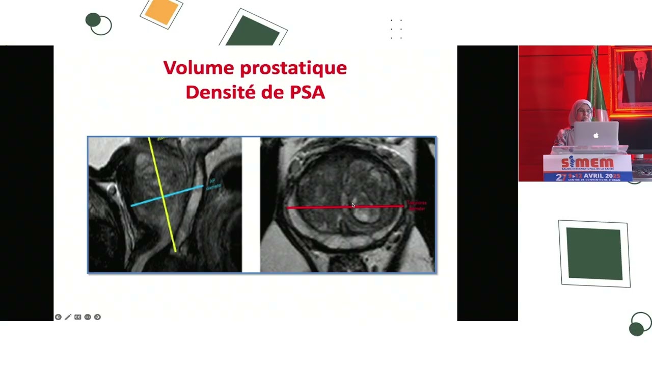 Pr Loughraieb CHU Mustapha Bacha