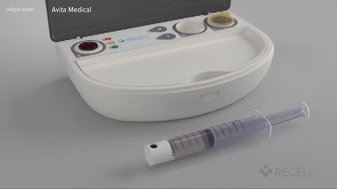 New device uses patient’s own skin cells to heal burns