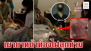 สยองเผายาหน้าท้องไฟคลอกร่างสาวสาหัส คลินิกเมินเยียวยา หมอหนีไปต่างประเทศแล้ว | ทุบโต๊ะข่าว | 4/12/66