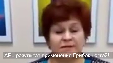 APL результат применения Грибок ногтей!