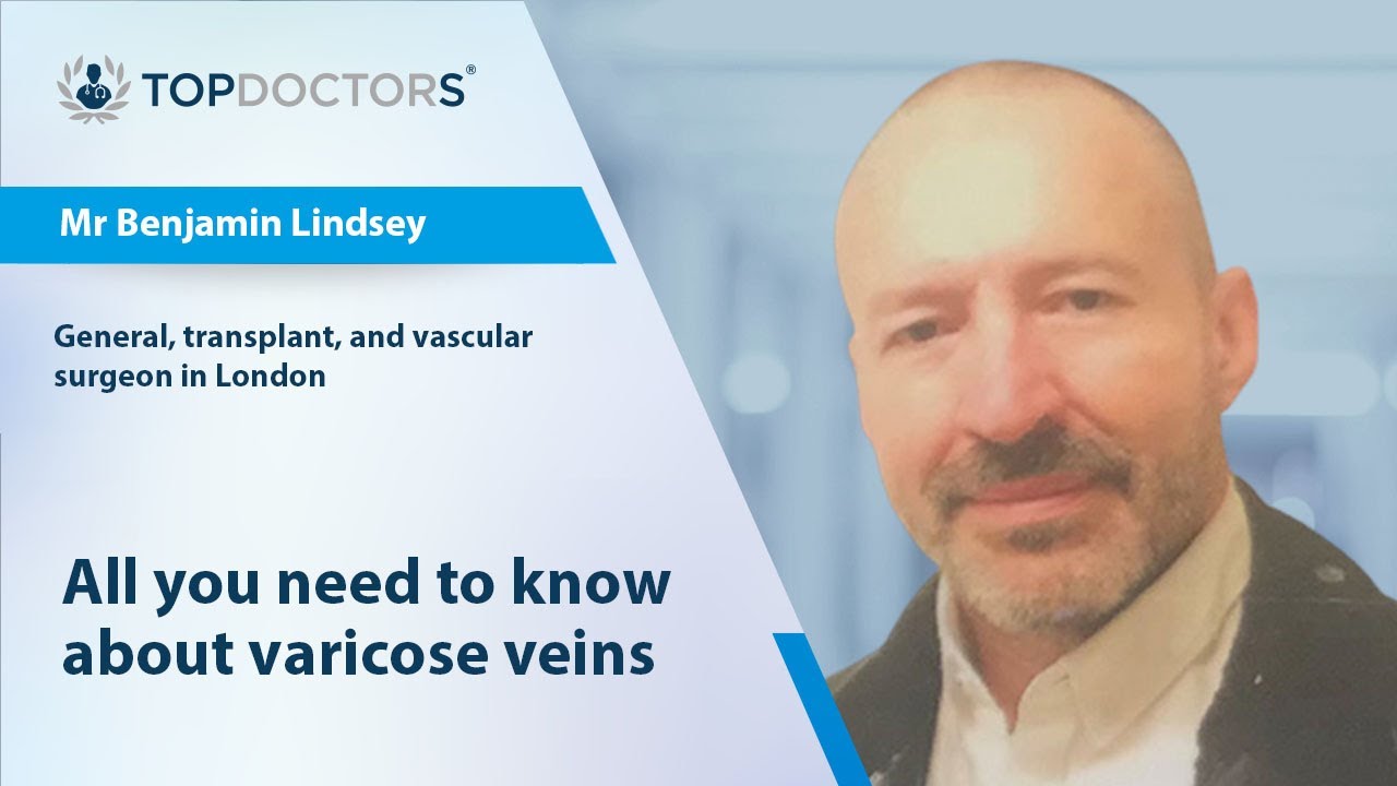 All you need to know about varicose veins - Online interview - YouTube