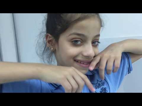 ركبت تقويم اسنان لون جديد