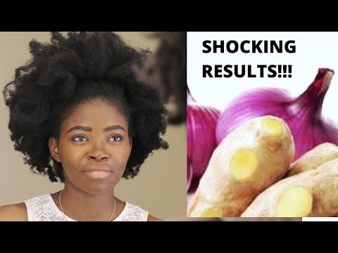 HOW TO USE ONIONS JUICE FOR MASSIVE HAIR GROWTH/HOW TO USE ONIONS USE FOR FAST HAIR GROWTH