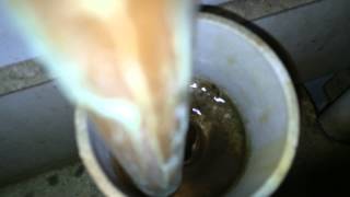 Keston C36 Multiple Organ Part Failure