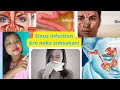 Sinusitis Ba Sinus Infection Na Noko Simsakani Home Remedies Achik Health Tips 