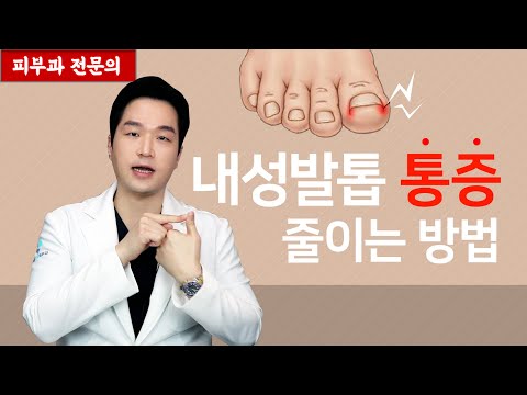 내성발톱 집에서 통증 줄이는 방법 | 간편하게 덜 아프기 [피부과전문의 피부심]