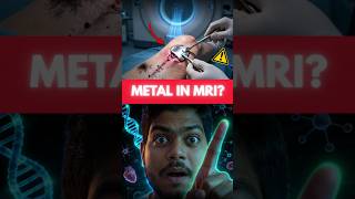 Why Steel Plates Are Removed Before MRI 😳 | Shocking Truth Explained