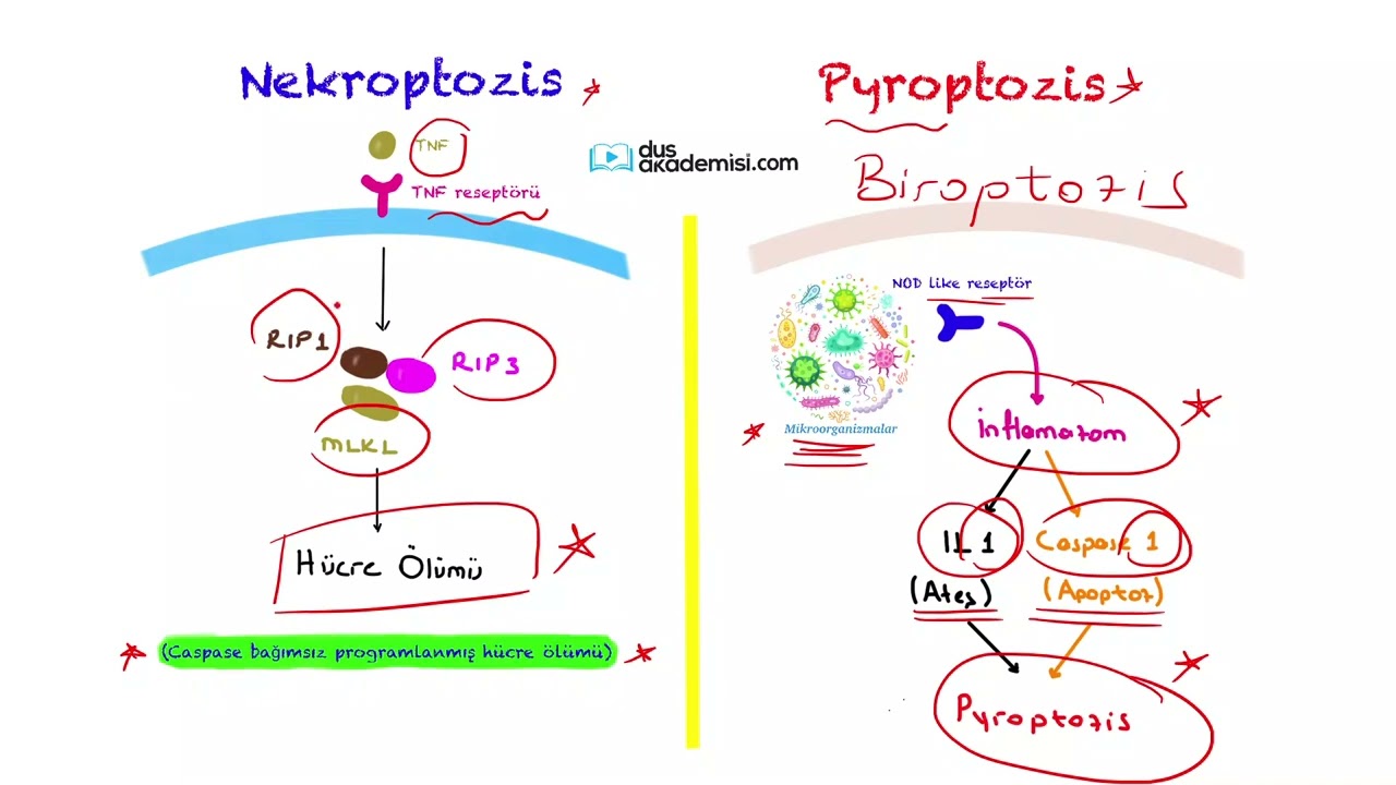 2023 Haziran DUS'a Yönelik Soru Çözümü 2023 Nisan TUS Çıkmış Patoloji Soru Benzerleri