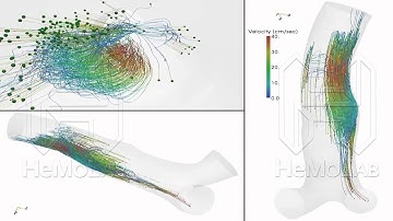 Blood flow - Particle tracing