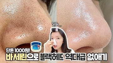 (ENG) 단돈 천원 !! 바세린으로 블랙헤드를 진짜 없애는게 가능할까?? black head remover Vaseline