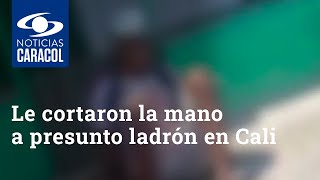 Aterrador: le cortaron la mano derecha a un presunto ladrón en el oriente de Cali