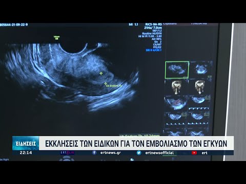 Βίντεο: Τι λέει το TC για τις έγκυες γυναίκες