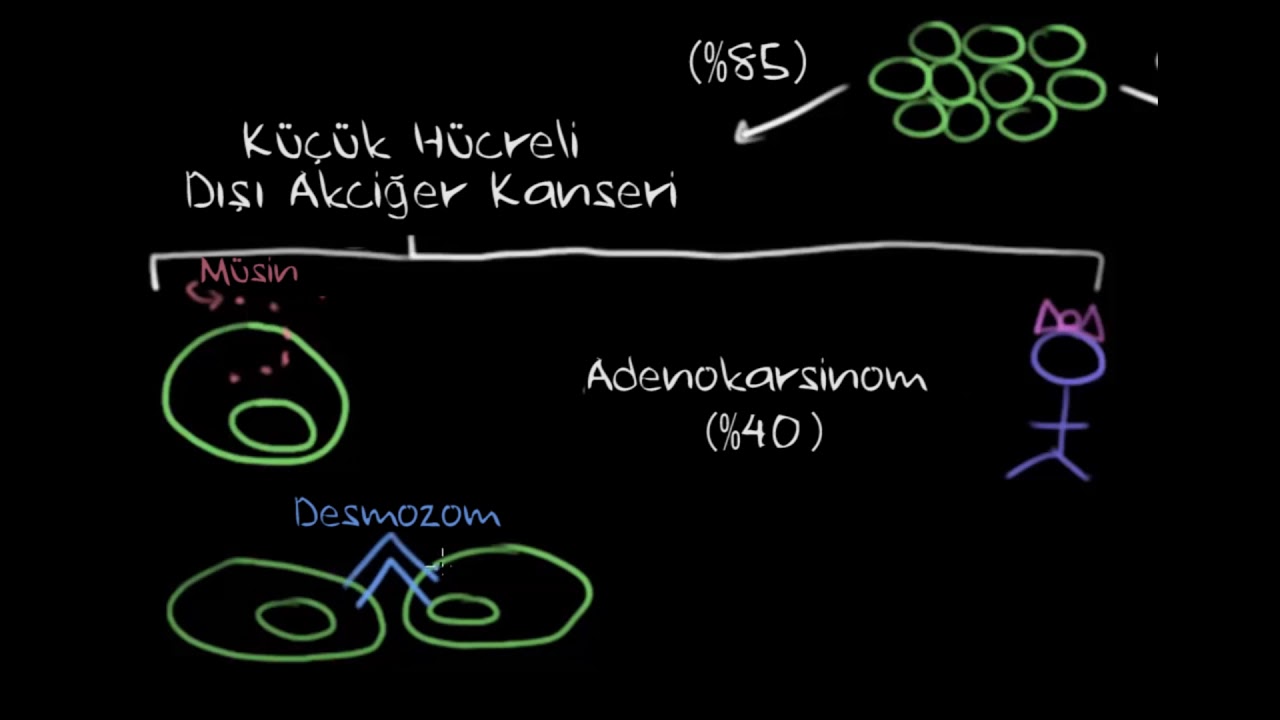 Akciğer Kanseri Çeşitleri (Fen Bilimleri)(Sağlık ve Tıp)