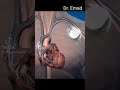 زراعة بطاريه القلب طبيب سوريا طبيبك في بيتك الدكتور مشاهدات اليوتيوب الجلطة  
