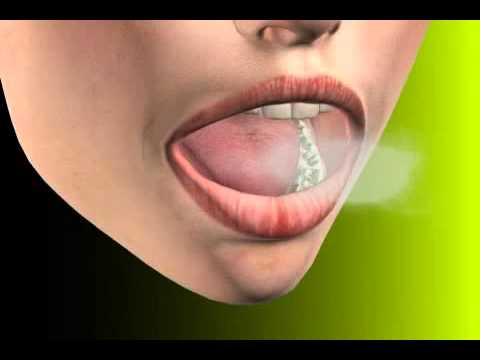 Video: Fetor Hepaticus: Smarža, Citi Simptomi, Cēloņi Un ārstēšana