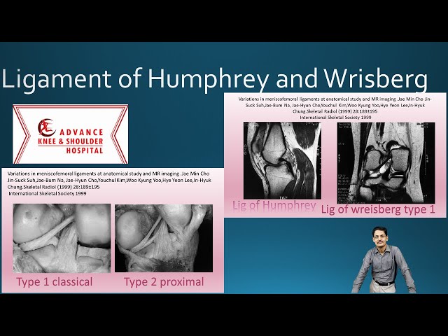 Ligamento De Wrisberg Anatomy_23] Meniscofemoral Ligament, Wrisberg