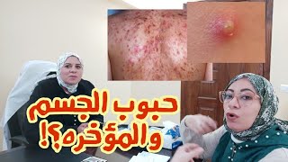 كيفية التخلص من حبوب الجسم والمؤخرهلكل عروسه للمراهقات