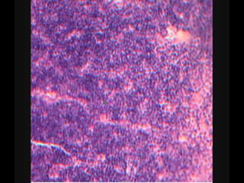 ТИМУС.  THYMUS.  Срез в световой микроскоп.