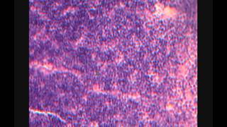 картинка: ТИМУС.  THYMUS.  Срез в световой микроскоп.