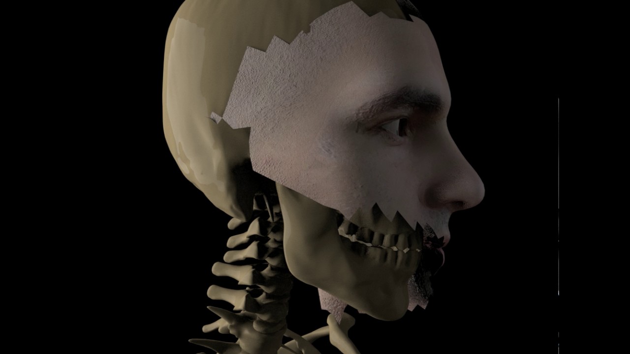 Skull-ray