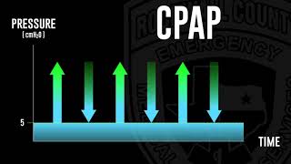 Short and Simple: CPAP vs BiPAP