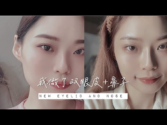 我做了我的双眼皮+鼻子｜ feat. BBLAB