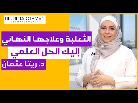 علاج الثعلبة بشكل نهائي 😍 👌| العلاجات الصحيحة للثعلبة