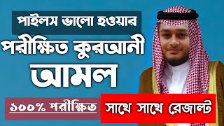 অর্শো গেজ পাইলস রোগ ভালো হওয়ার আমল দোয়া উপায় অজিফা তদবির টোটকা মন্ত্র ওষুধ চিকিৎসা | amal | dowa