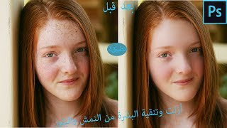7-تنقية البشرة من البثور والنمش بستخدام برنامج الفوتوشوب screenshot 4