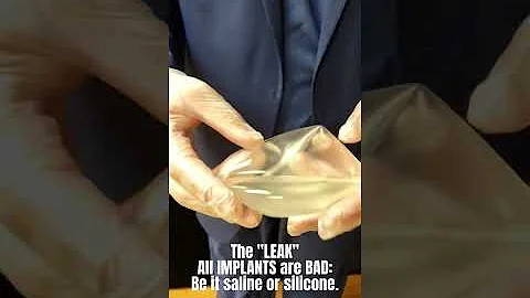 "LEAKY BREAST IMPLANT" ---THE LEAK --- MUST WATCH! SALINE BREAST IMPLANT: NOT SAFE!