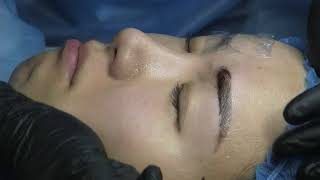 David's Microblading Full Procedure
