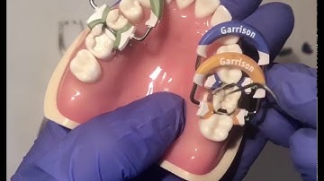 Composi Tight® 3D Fusion™ Vidéo pédagogique | Français