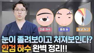 눈이 졸려보이고 피곤해보이는 '안검 하수'의 기준을 알려 드립니다!! Feat.(과연 나도 안검 하수 일까?)_[부산성형외과]