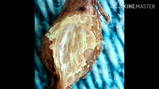 Nematodes In Pomegranate Plants Roots...