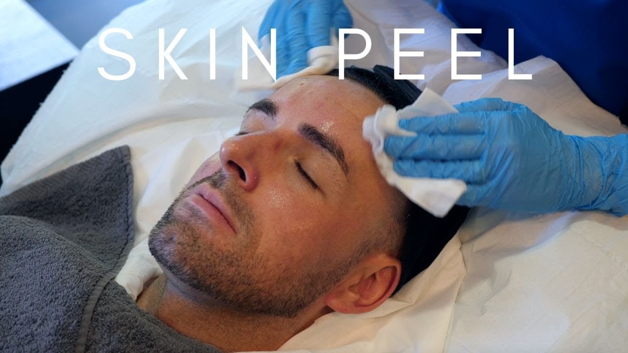 Obagi Blue Peel Radiance The Laser and Skin Clinic YouTube Obagi Blue Peel Radiance The Laser and Skin Clinic YouTube