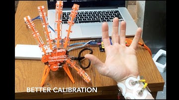 Signal Classification to Control Robotic Hand