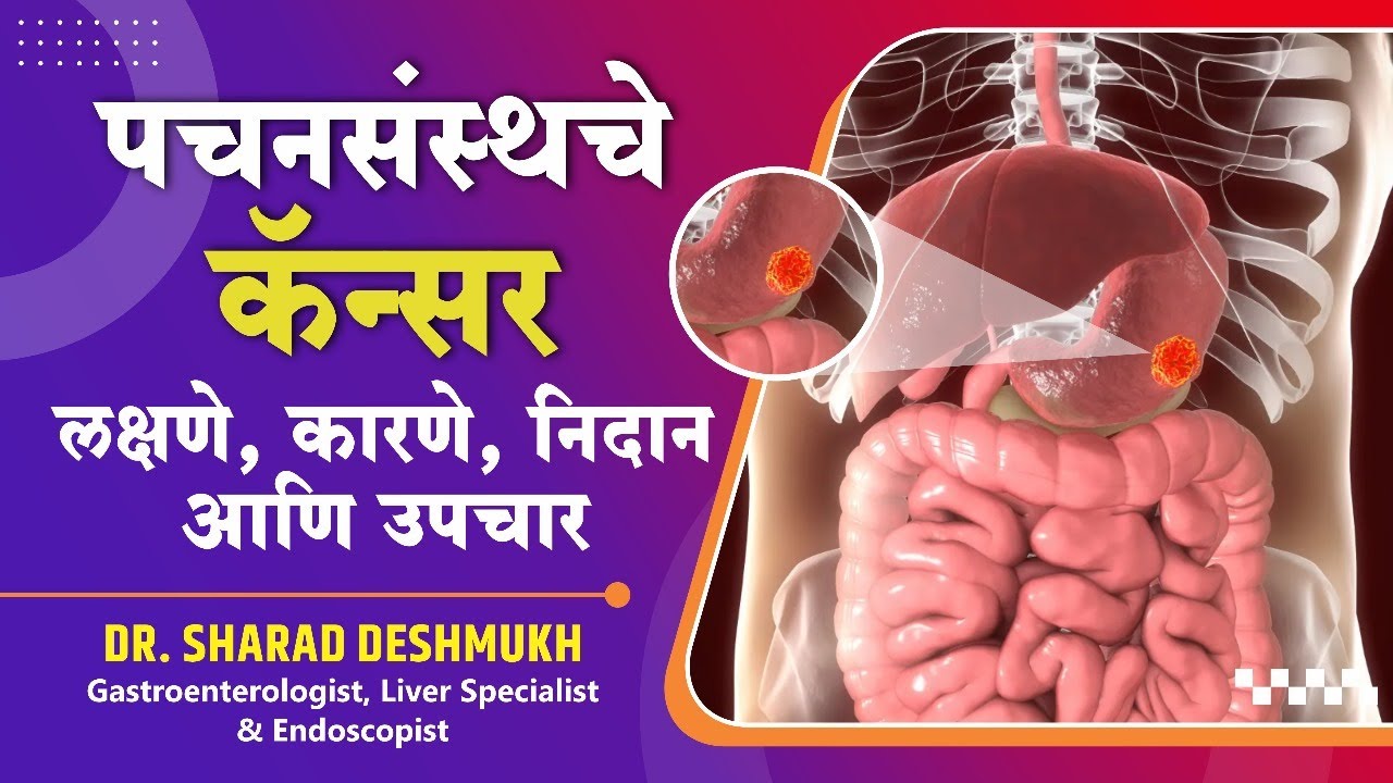 पचनसंस्थचे कॅन्सर लक्षणे, कारणे, निदान आणि उपचार  #cancer #stomachcancer #gastriccancer #digestion