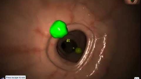 EndoSim Fundamental Endoscopy Skills 1: Button Handling