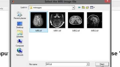 MULTIMODAL MEDICAL IMAGE FUSION USING NSCT