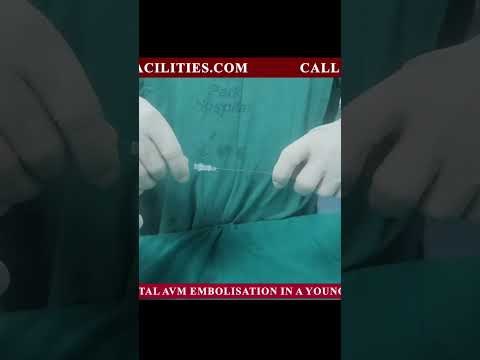 SHORTS FRONTAL AVM EMBOLIZATION IN A YOUNG BOY #IRFACILITIES