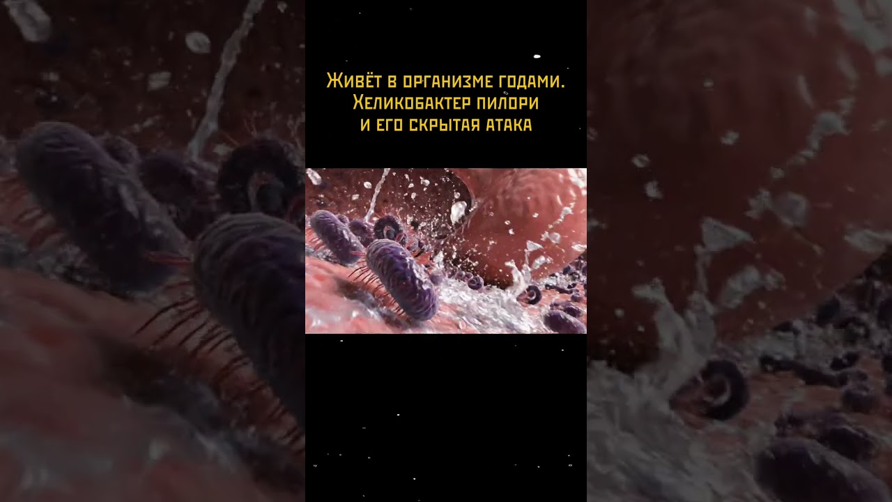 Живёт в организме годами. Хеликобактер пилори и его скрытая атака