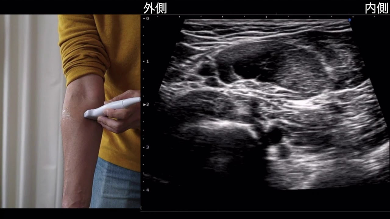 前腕世界一周①