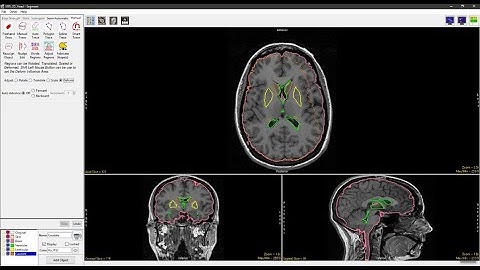 Analyze 15.0 - Segment: Adjust Regions
