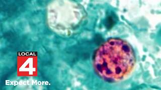 Michigan cyclosporiasis outbreak grows to 700 reported cases