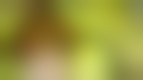 Stryker SPY PHI Open  Parathyroid Perfusion after Thyroidectomy