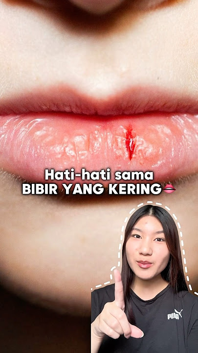 Jangan sepelein bibir yang kering, HATI-HATI‼️ #lipcare #bibirkering #douyin_china