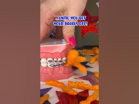 CHIPS YOU CAN EAT WITH BRACES ON 👀 ORTHODONTIST REACTS TO CHEETOS