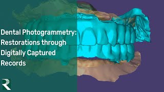 Full Arch Dental Photogrammetry: Restorations Through Digitally Captured Records