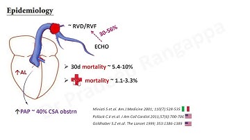 RV (Right Ventricle) in ICU ~ Overlooked