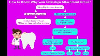 How to Avoid Invisalign or Clear Aligner Attachment Breakage